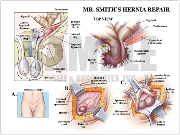 MSTRUSTHOSPITAL-surgery4