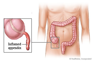 MSTRUSTHOSPITAL-surgery5
