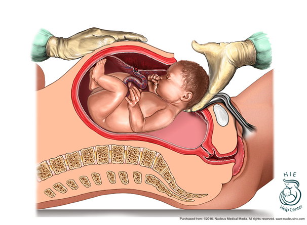 MSTRUSTHOSPITAL-surgery6