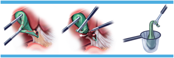MSTRUSTHOSPITAL-surgery7